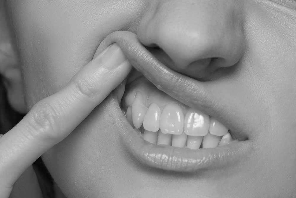 Woman lifting lip with periodontal disease